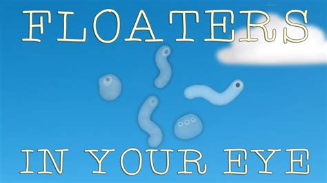 A Ted Ed Animation Explaining The Nature Of Those Floating