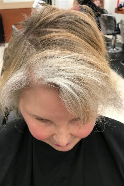 Gray Hair Turning Other Colors Aging At Your Best