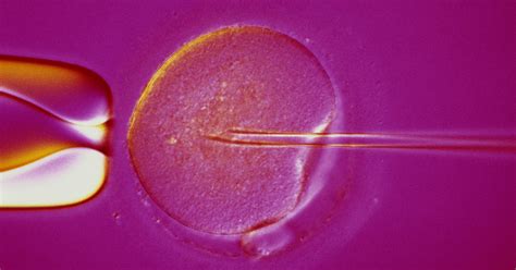Ivf Fertility Clinic Getting Pregnant With Pcos