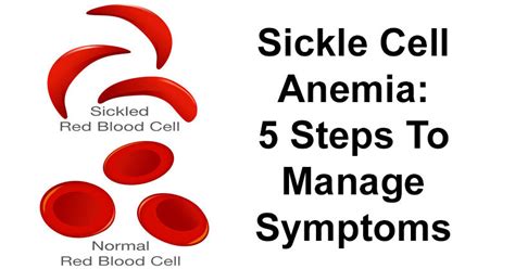 It is caused by an inherited abnormal hemoglobin that decreases life expectancy. Sickle Cell Anemia: 5 Steps To Manage Symptoms ...