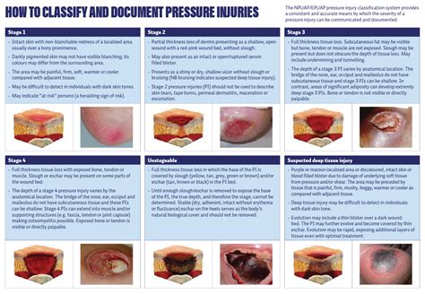New Zealand Wound Care Society Pressure Injury Clinical Resources