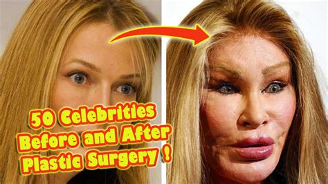 Celebrities Who Destroyed Themselves With Plastic Surgery Youtube