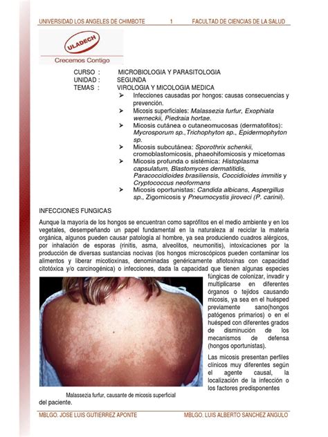 Infecciones Causadas Por Hongos Causas Consecuencias Y Prevencion
