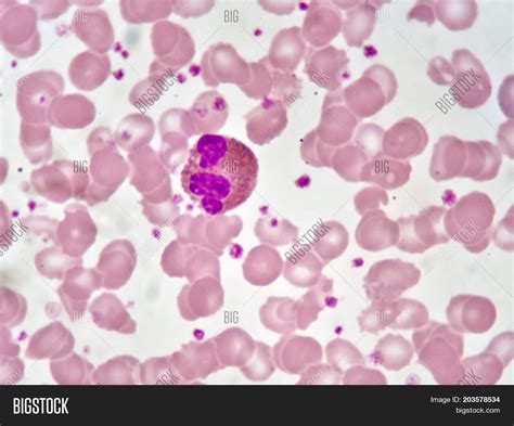 Eosinophil Cells Blood Image And Photo Free Trial Bigstock