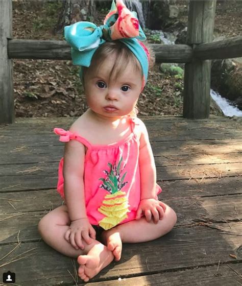 Down syndrome adoption down syndrome awareness month down syndrome kids precious children beautiful children beautiful babies down sydrome child of the universe pregnancy and infant loss. Photos of Babies With Down Syndrome | POPSUGAR Family Photo 53