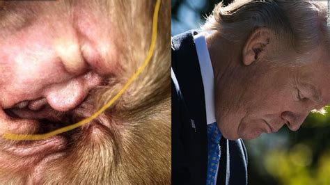 Trumps Face Found In A Dogs Ear Cnn Video
