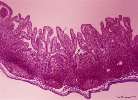 Ileum With Peyers Patches ‘gut Associated Lymphatic Tissue Or Galt