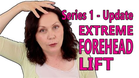 Face Exercise For Forehead Wrinkles Youtube Antiagingwrinklecream Face Exercises Facial