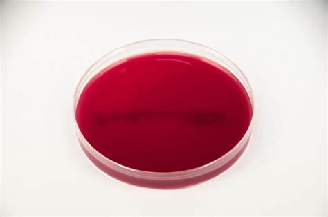 Tryptic Soy Blood Agar Tsba Anaerobe Systems