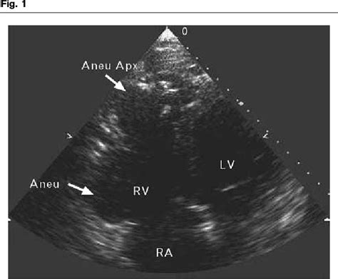 Figure 1 From Improved Delineation Of Morphological Features Of