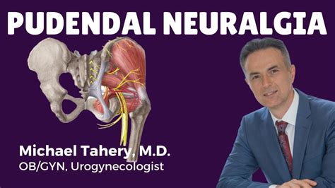 Pudendal Neuralgia Treatment Los Angeles Dr Michael Tahery Youtube