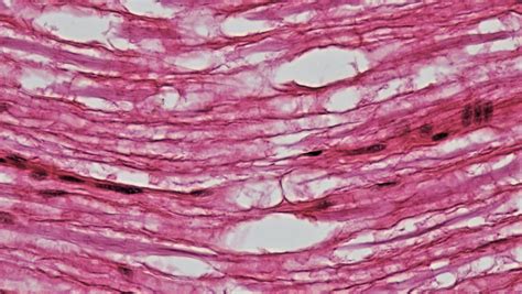 Nervous Tissue Under Microscope 400x Micropedia