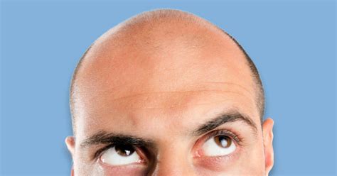 Have Scientists Just Found A Cure For Baldness Metro News