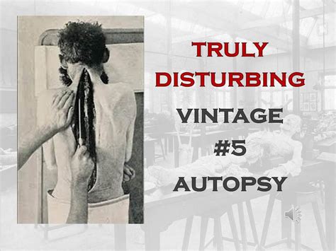 Truly Disturbing Vintage Photos 5 Autopsy Redux Youtube