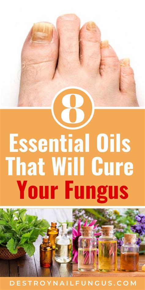 One Of The Most Persistent Foot Issues Is Toenail Fungus Not Only Is