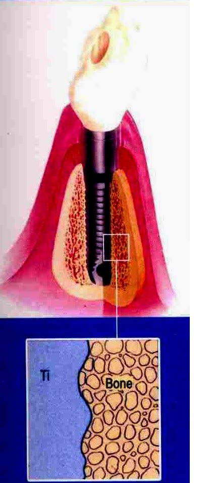 Sevadharma Dental Clinic Types Of Integration