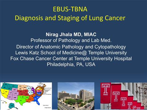 Pdf Ebus Tbna Diagnosis And Staging Of Lung Cancer€¦ · Just Got The