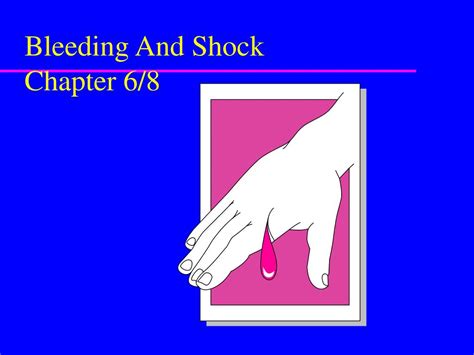 Ppt Bleeding And Shock Chapter 68 Powerpoint Presentation Free