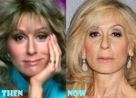 Judith Light Plastic Surgery Before After Photos Lovely Surgery