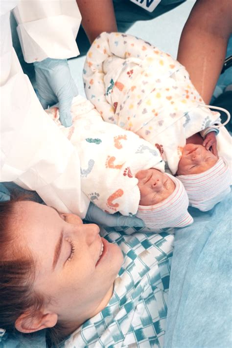mono mono twins success story morning sickness was symptom of rare twin pregnancy