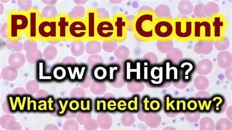 Platelet Count Thrombocytopenia Low Platelet Count And