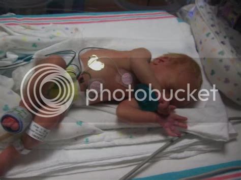Properphohe Pics Of Babies Born At 30 Weeks