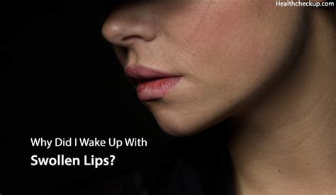 Woke Up With Swollen Lips Causes Treament And Home Remedies