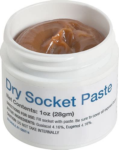 How To Apply Dry Socket Paste Dental Market