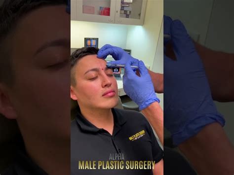 Dr Steinbrechs Video Library On Male Plastic Surgery Watch Nowmale