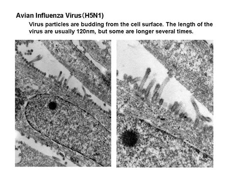 Niahniah Pathogenic Organisms Observed By Electron Microscopeavian Influenza Virus