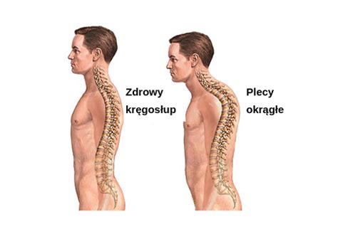 eFizjoteka pl Plecy okrągłe