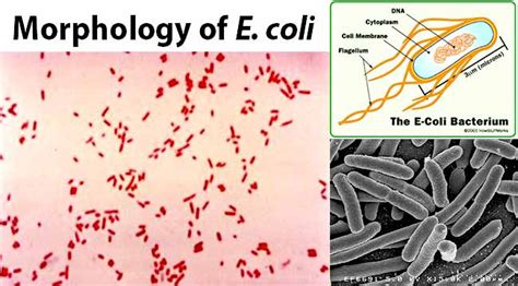 E Coli Escherichia Coli An Overview Microbe Notes 2022