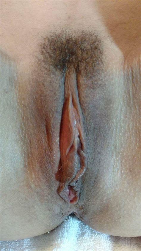 Poll Labia Minora From Hidden To Large Take Your Pick Page 2