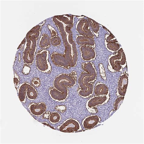 Tissue Expression Of Epcam Staining In Endometrium The Human