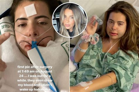 Brielle Biermann Reveals Severe Swelling After Jaw Surgery