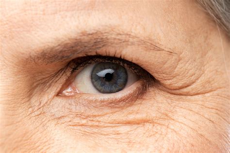 What Causes Wrinkles In Your Skin Premier Spa And Laser Center