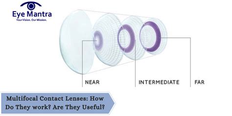 Multifocal Contact Lenses How Do They Work Are They Useful