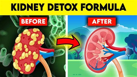 How To Detox And Cleanse Your Kidneys Naturally Best Foods For Healthy