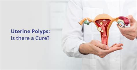 What Is Uterine Polyps Causes And Treatment Birla Fertility And Ivf