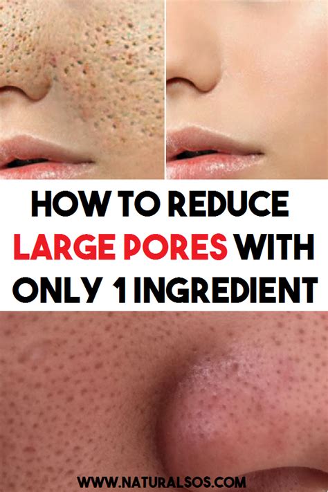 Skin Care Routine For Large Pores Beauty And Health