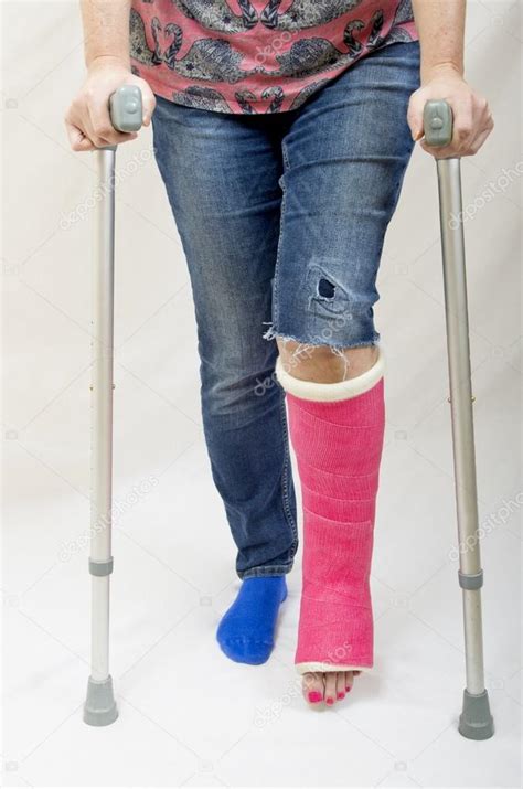 Crutches Broken Leg Tips How To Walk With Crutches