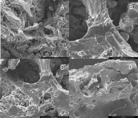 Images Of Trabecular Bone In Osteoporotic Women Under Sem A