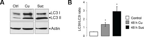 Figure 1 From Copper Induced Activation Of Transcription Factor Eb And