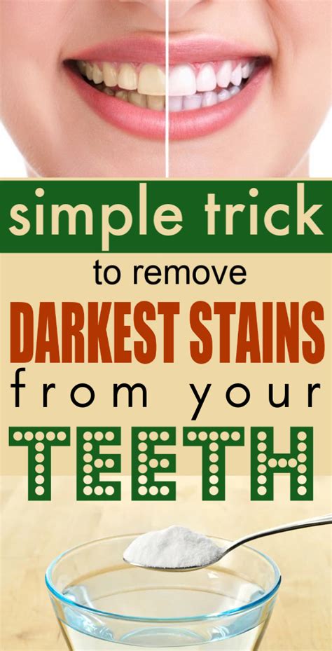 10 Effective Home Remedies To Remove Stains From Teeth Martlabpro