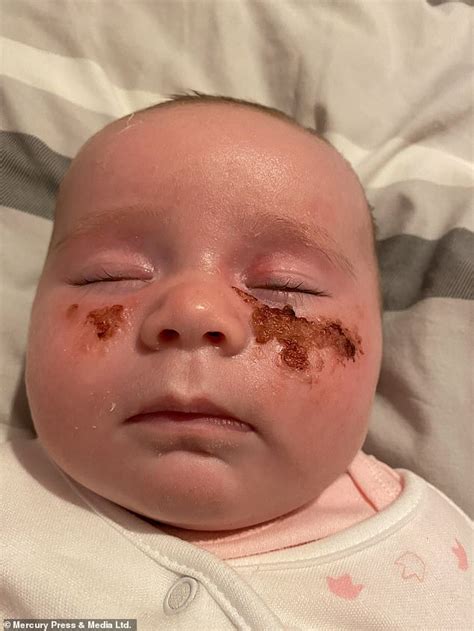 Mother Issues Warning Over Toxic Giant Hogweed Plant After Her Baby