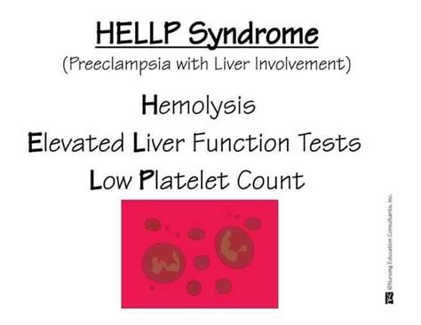 Pin By Melissa Wirz On Nursing Low Platelets Low Platelet Count
