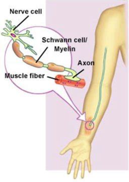 Déficit en carnitine palmitoyltransférase ii; Living with CMT: Key Topics