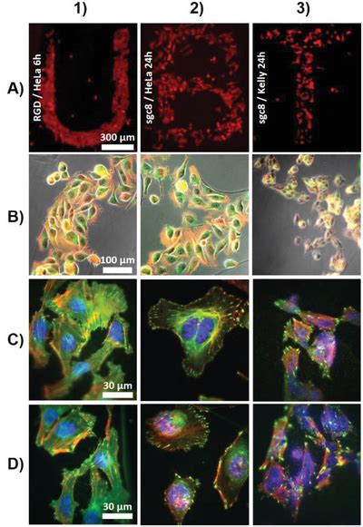 Spreading Hela And Kelly Cells On Micropatterned Protein Networks Hela