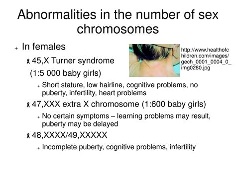 Disorders With Chromosome Abnormalities Plastic Surgery Key