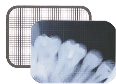 Transparent Manual Dental Xray Grid Iopa Packaging Type Packet 100